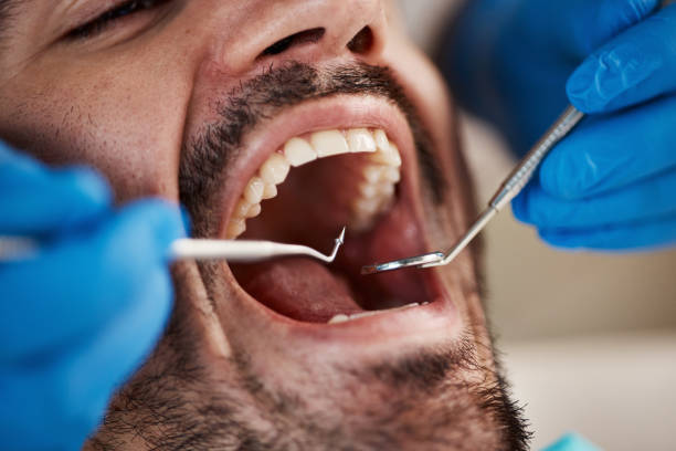 Best Oral Cancer Screening  in California, MO